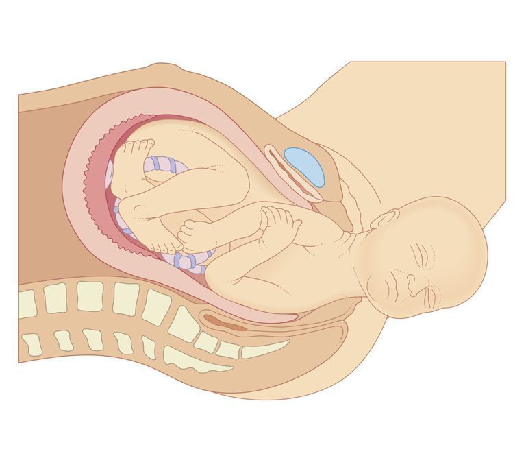 Safe to orgasm after cesarean section
