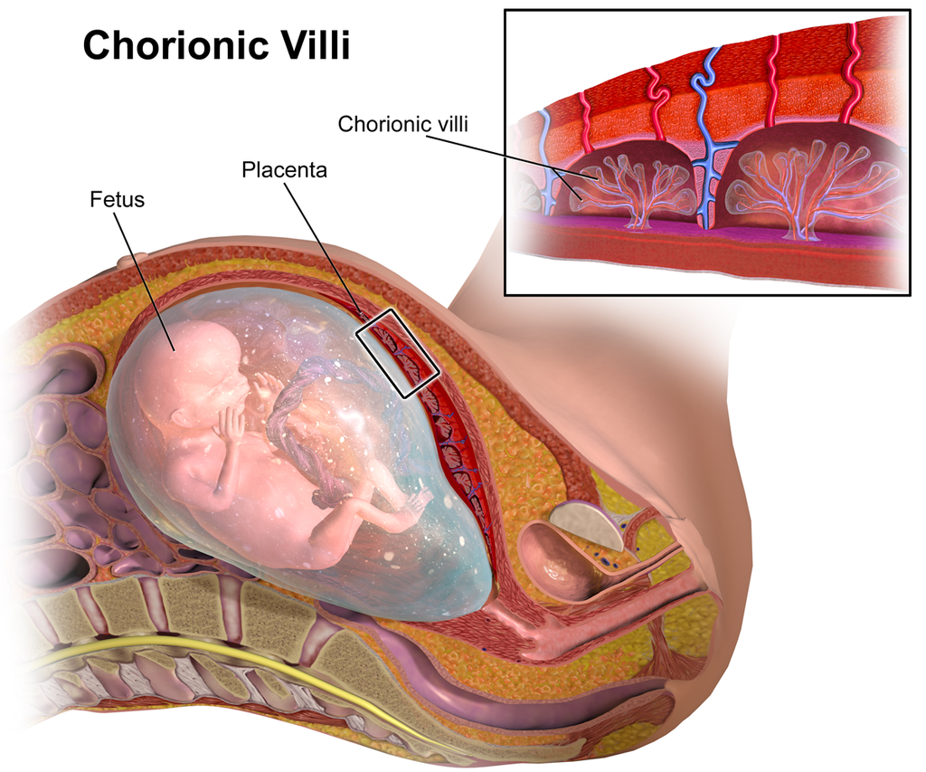 Biopsia Choriale o prelievo di villi coriali