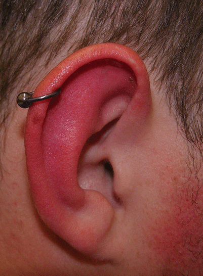 Fotky typů piercingu v chrupavce ucha