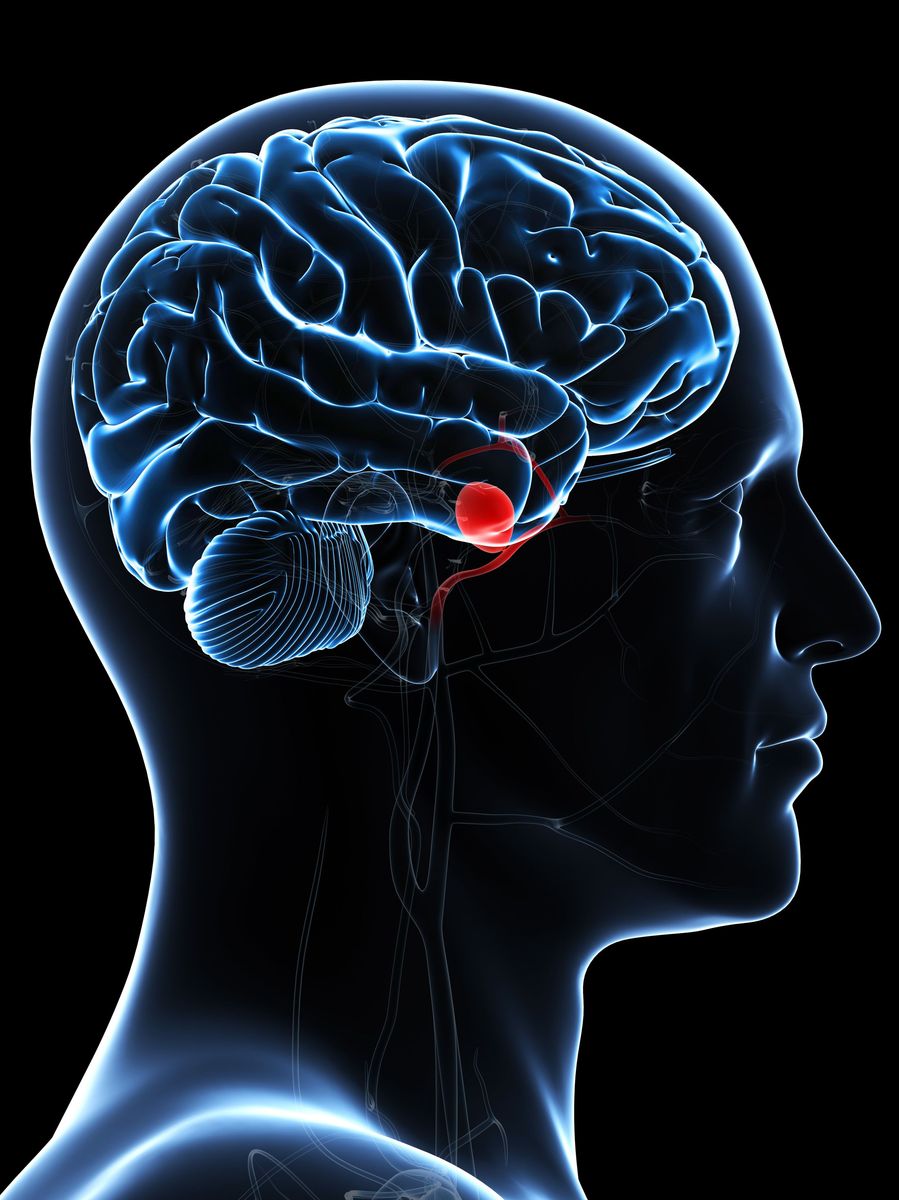 Co byste měli vědět o aneuryzmatu mozku