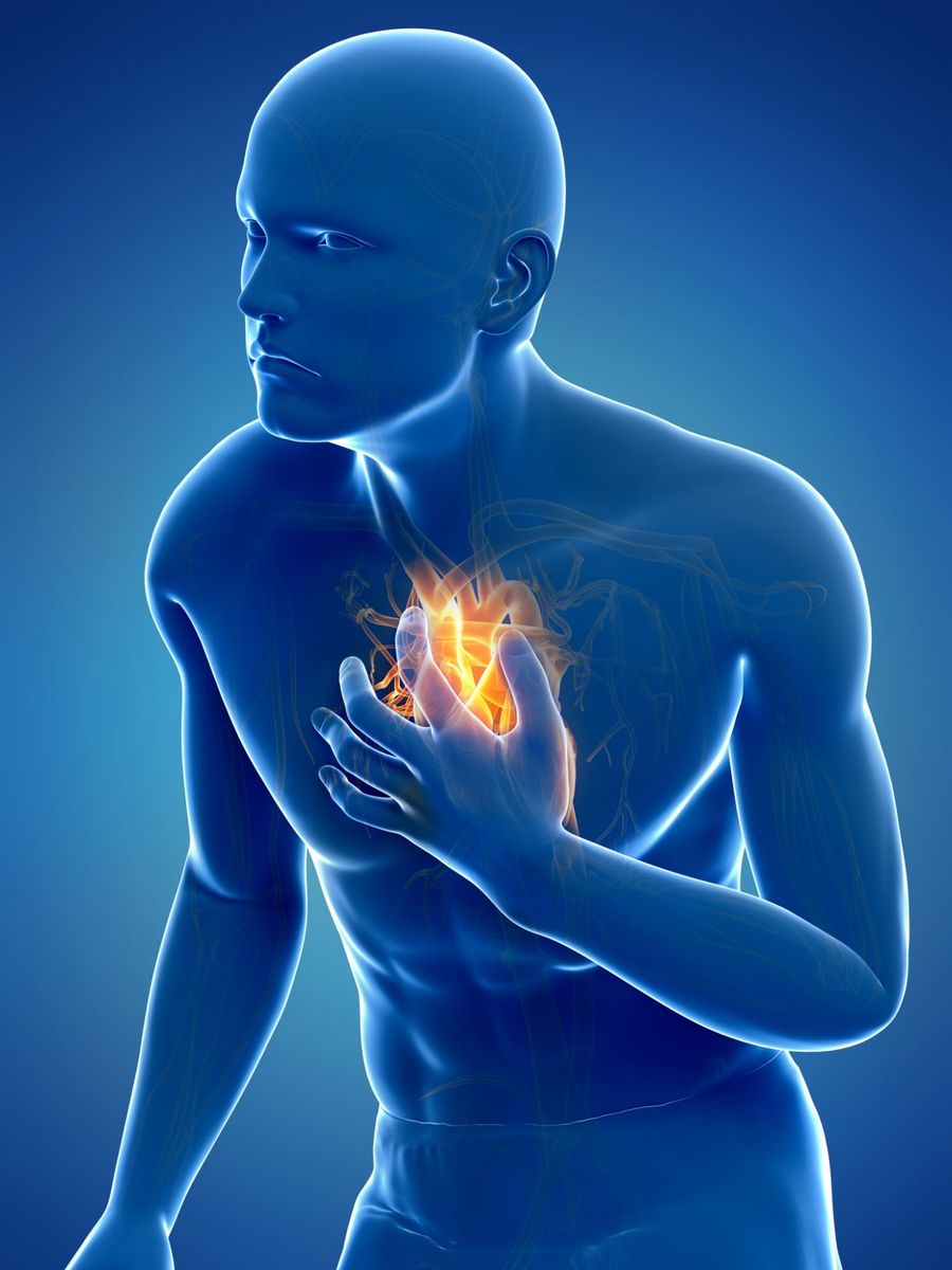 Was sind die Symptome eines Herzinfarktes?