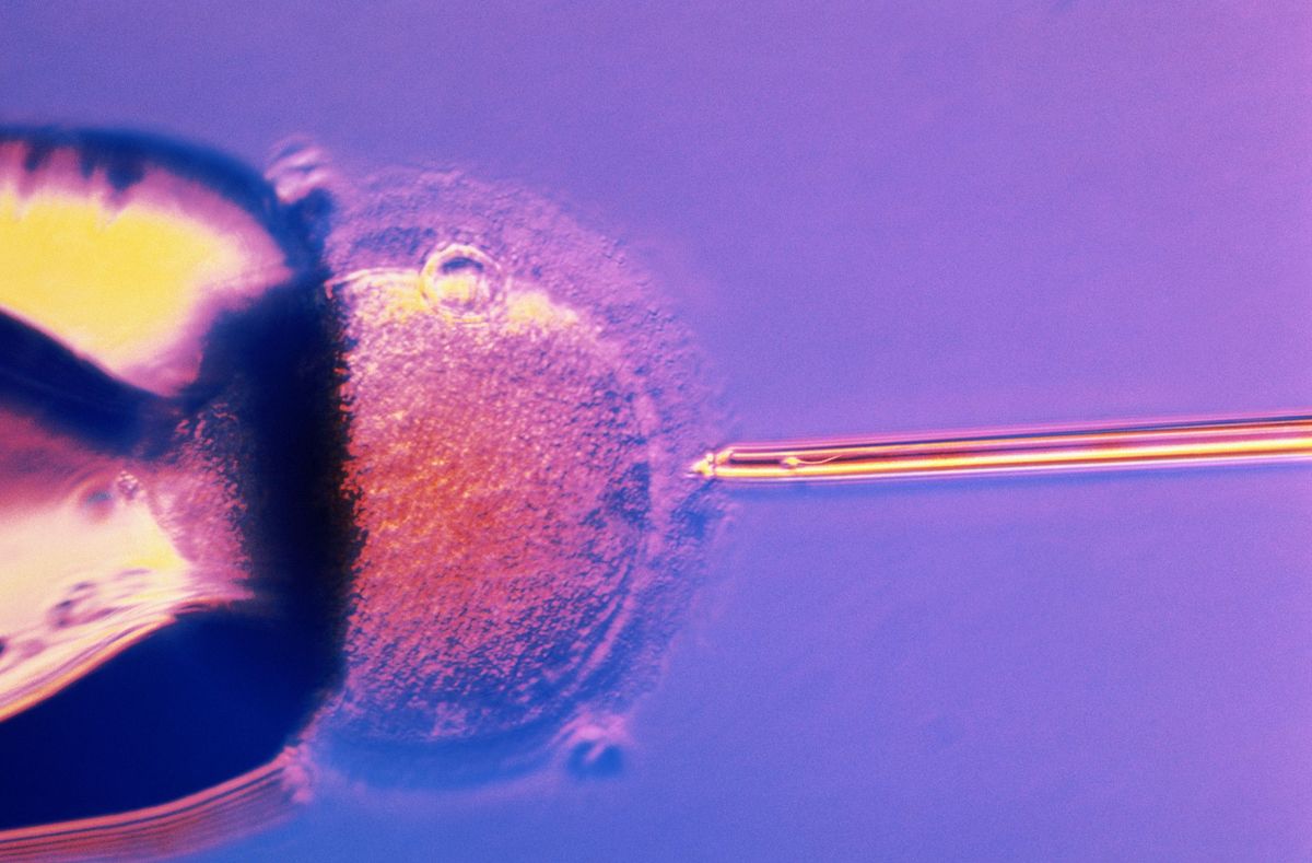 Pagalbinės reprodukcijos technologijos apvaisinimas in vitro